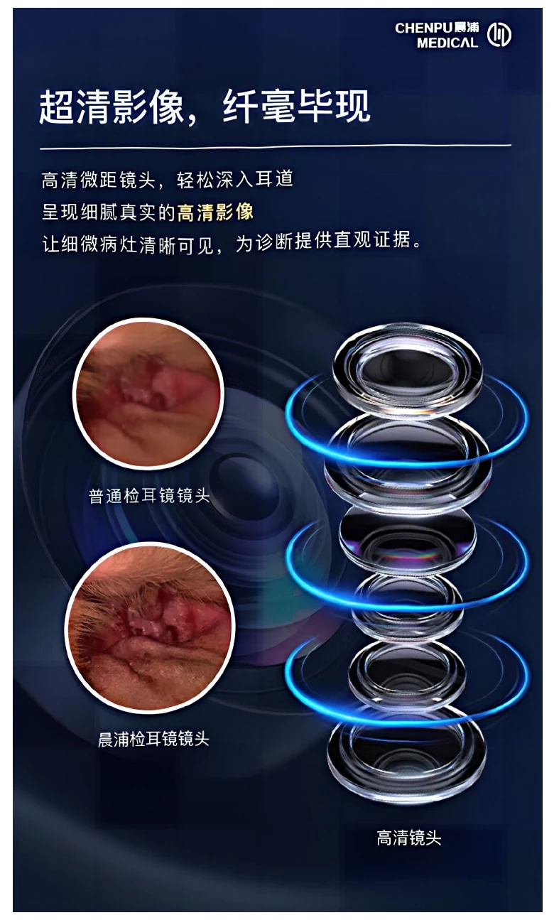 宠物 AI 检耳镜高清成像与镜头对比